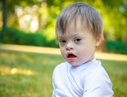 Is Down Syndrome Curable? – OrbRom Center